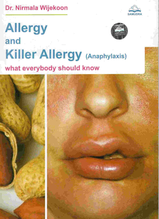 Allergy & Killer Allergy